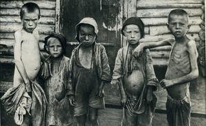 Фотомарафон «100-летие ТАССР»: истощенные дети, 1920 год