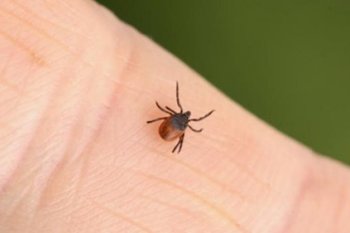 В Татарстане за неделю 100 человек пострадали от укусов клещей, почти половина — дети