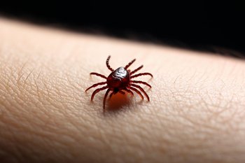 В Татарстане клещи покусали почти 9 тысяч человек