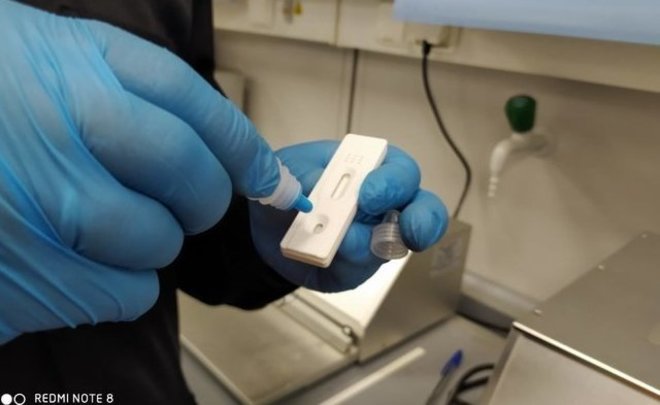 В Татарстане у 5% прошедших тестирование выявили антитела к коронавирусу