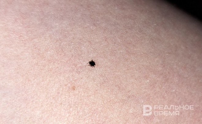 В Татарстане за медпомощью из-за укусов клещей обратились 6,8 тысячи человек