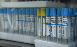 В России разрабатывают препарат, который останавливает размножение коронавируса