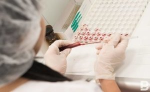 За 11 месяцев в Уфе зарегистрировано более 600 новых случаев заражения ВИЧ