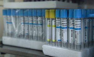 Главное о коронавирусе на 22 мая: Испания смягчила правила въезда, США предложили КНДР вакцины от COVID-19