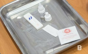 Сегодня жители Казани смогут пройти бесплатное анонимное тестирование на ВИЧ