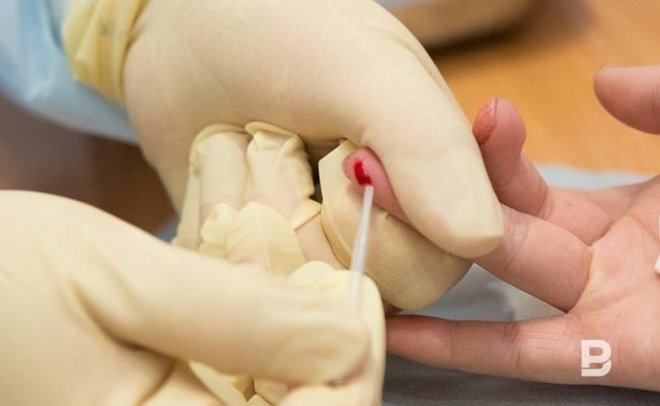 Голикова: более 1,1 миллиона россиян заражены ВИЧ