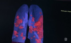 Женщины болеют раком чаще, чем мужчины