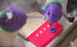 В Татарстане выросла заболеваемость сифилисом