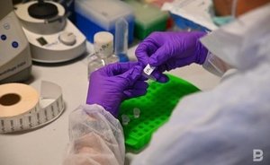 В мире зафиксировали почти 14 тысяч случаев заражения оспой обезьян